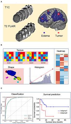 Predicting Survival Duration With MRI Radiomics of Brain Metastases From Non-small Cell Lung Cancer